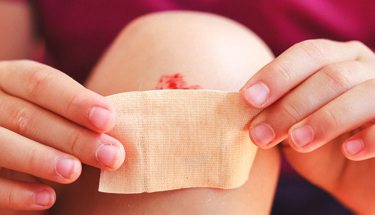 10 ماده طبیعی برای بهبود انواع زخم